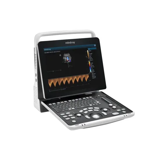 Ecografo portatile Mindray Z50