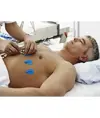 elettrodi per ECG
