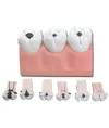 Modello carie dimensioni 4 a 1 con 3 denti