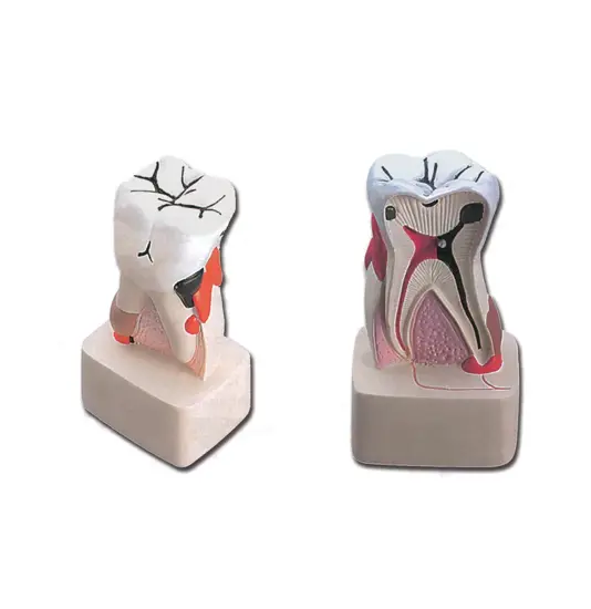 Modello patologia dentale