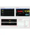 Monitor fetale FC1400
