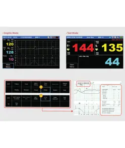 Monitor fetale FC1400