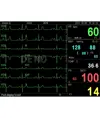 Monitor multiparametrico PC-3000