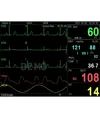 Monitor multiparametrico PC-3000