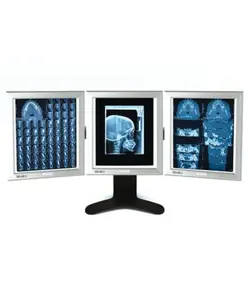 Negativoscopi ultrapiatti a led