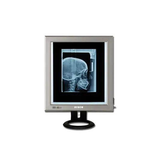 Negativoscopi ultrapiatti a led
