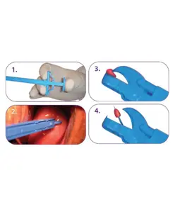 Pinze per biopsia cervicale