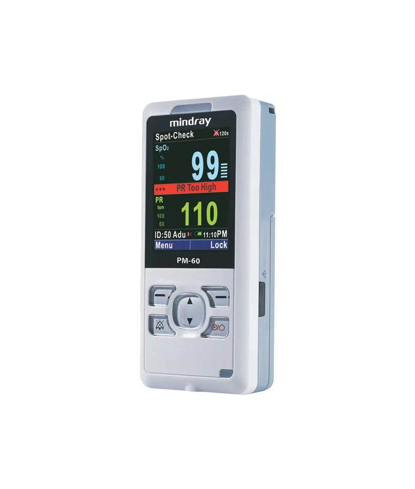 Pulsossimetro Mindray PM-60, assegnazione automatica dell'ID del paziente