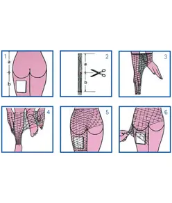 Rete tubolare per corpo/pelvi/coscia