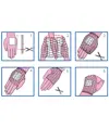 Rete tubolare per polso/mano Poly Surgifix