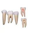 Set 3 denti