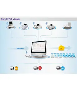 Software ECG
